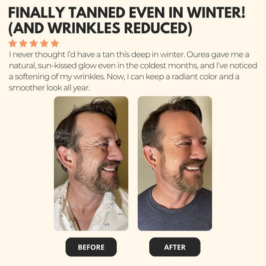 Sunvita – Il mix di carotenoidi per un incarnato luminoso e naturale